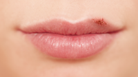 Lippen 3