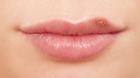 Lippen 2